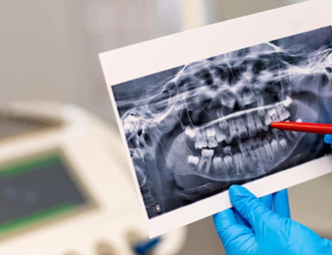 Как происходит удаление зубного нерва